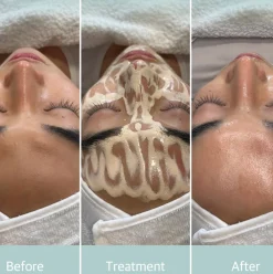 Stayve BB Glow Starter Kit 12 x 8 ml